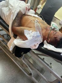 Tiros y piedrazos por choque de barras en un hospital de La Plata 